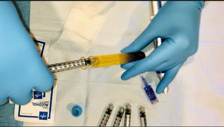 Microneedling With Prp Preparation Step By Step Juventix